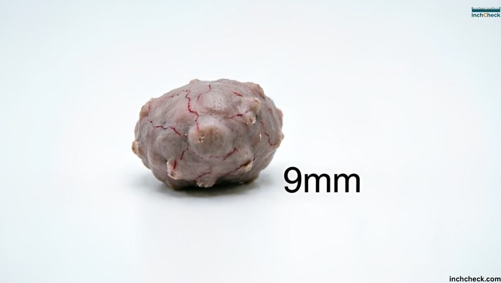 How Big Is 9mm Tumor?
